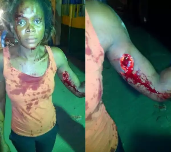 Photos: Couple arrested in Lekki for stabbing their neighbours with broken bottle